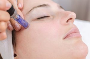 Tips On Preparing For Your First Dermapen Treatment